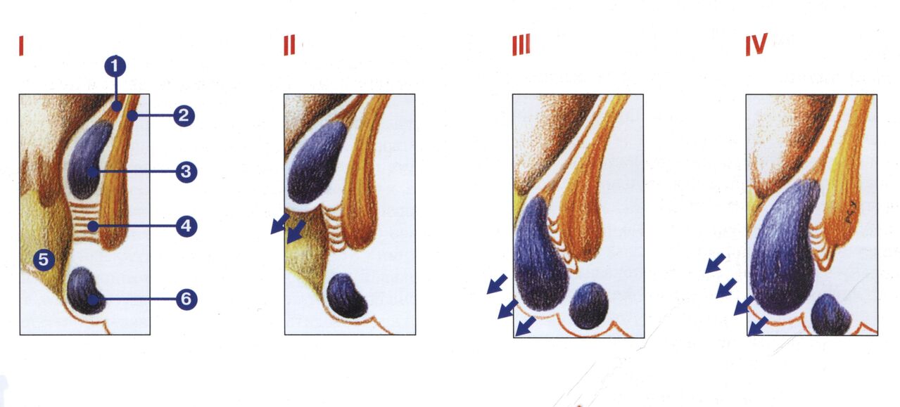 hemorroideen garapenaren faseak